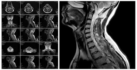 Does an MRI Show a Pinched Nerve? And Why Do Bananas Dream of Electric Sheep?