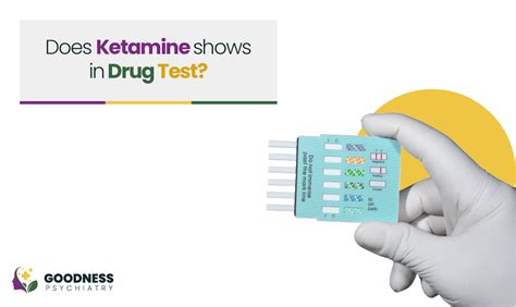 Does Ketamine Show Up in Drug Tests? Exploring the Unpredictable Dance of Molecules and Morality